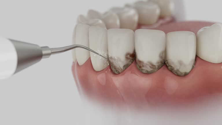 Reliable Dental Implants contractor in Denmark, SC by Smile Center Dentistry
